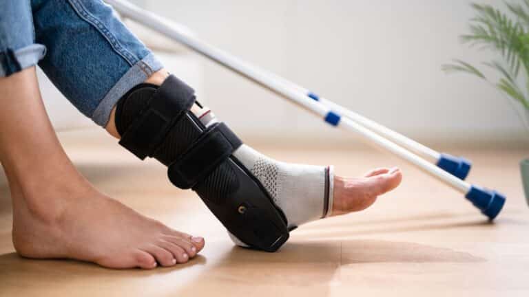 אישה שברה את הקרסול ואיבדה את כושר העבודה שלה